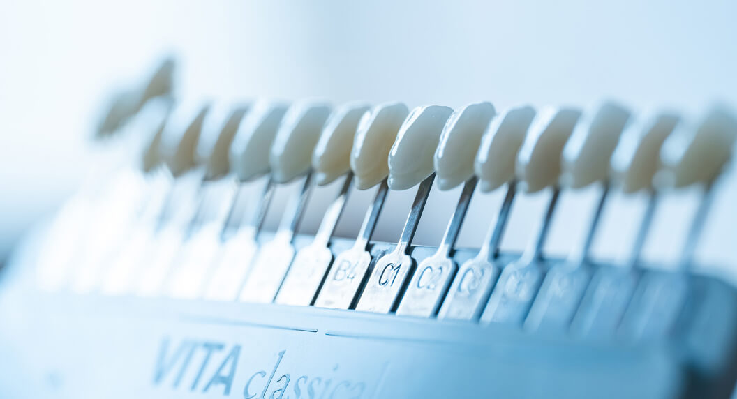 「自然で美しい見た目」を実現する、セラミック治療の精密な色合わせに用いるシェードガイド