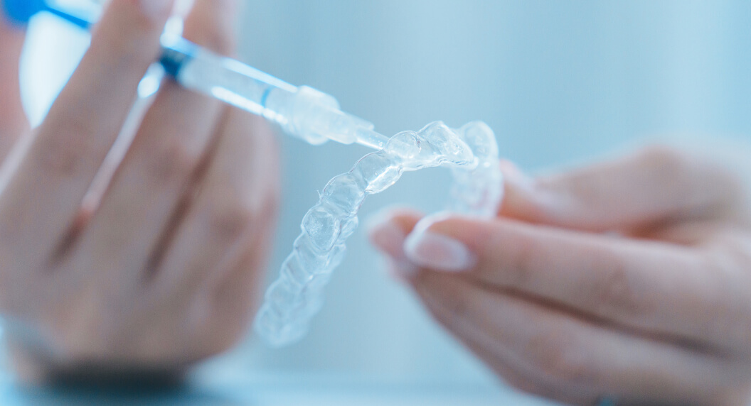 自宅で行うホームホワイトニングのため、専用のマウスピースにジェルを準備する