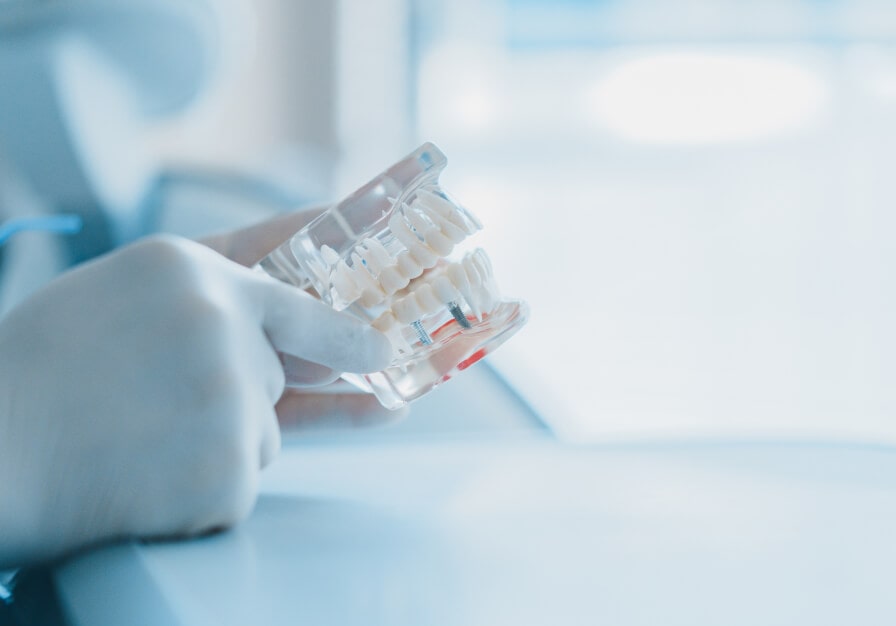 患者様が視覚的に理解できるよう、顎の模型を使ってカウンセリングしている様子