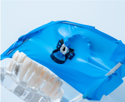 唾液や細菌の侵入を防ぎ、治療の精度と安全性を高めるラバーダム