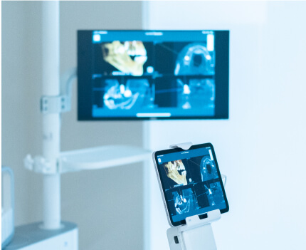 歯科用CTで得た診断データを、診療室の各モニターで確認・活用する