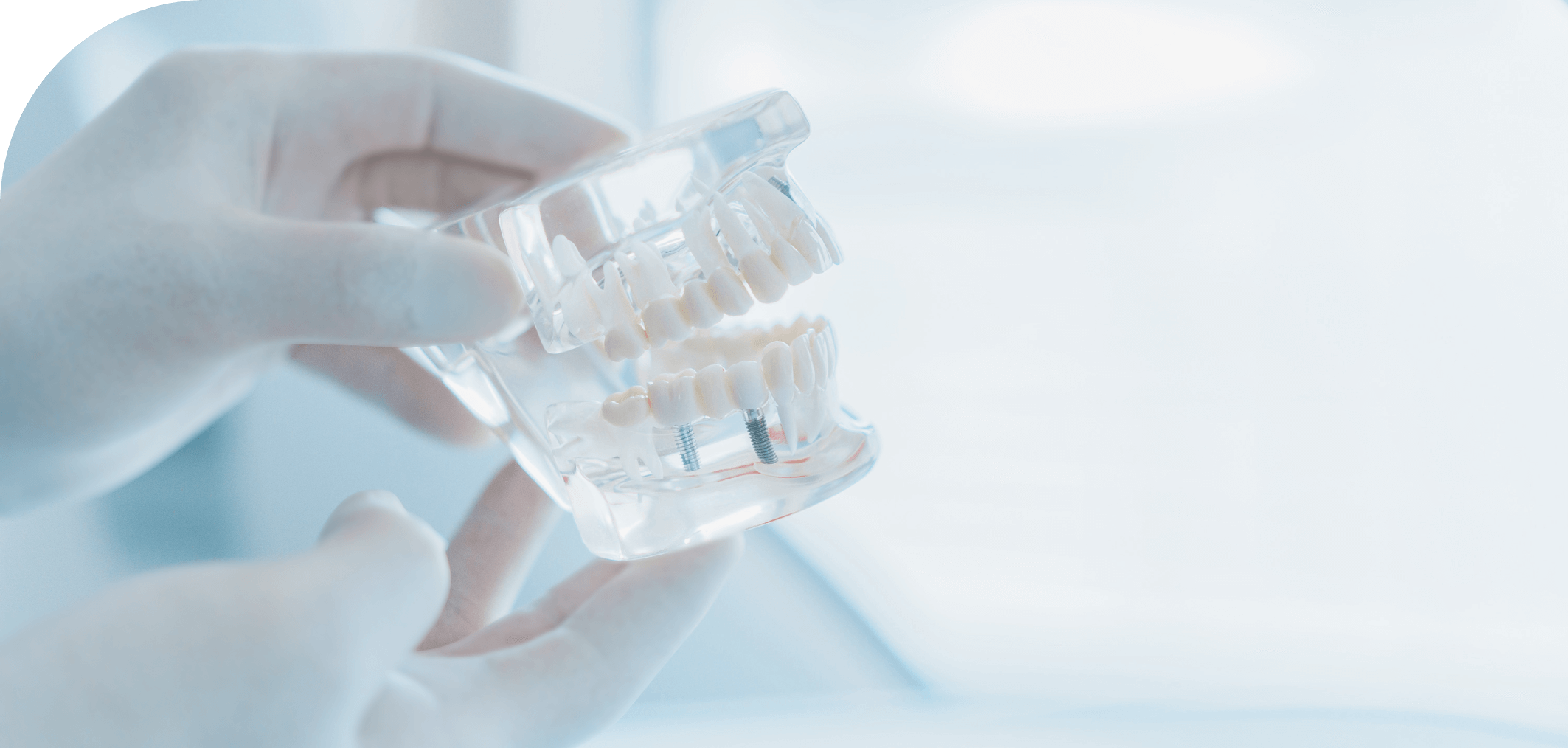 「食べられる喜び」を支えるインプラント治療について説明しているイメージ