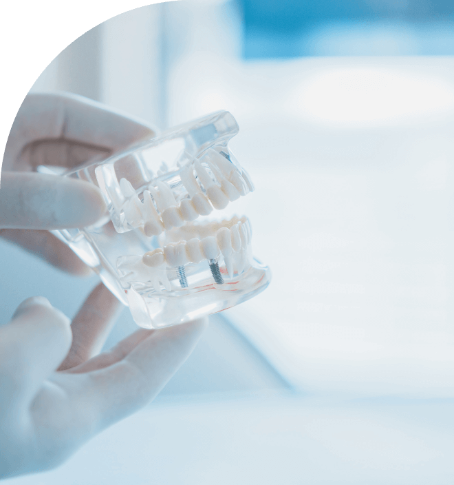 「食べられる喜び」を支えるインプラント治療について説明しているイメージ